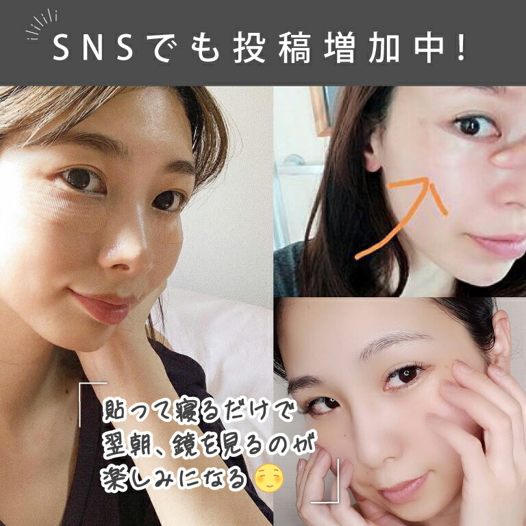 楽天市場】【公式】クオニス ダーマフィラー プレミア 8回分 ｜針 目元