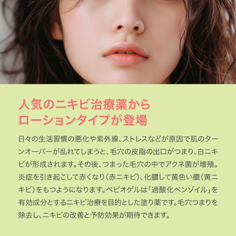 ベピオローション2.5％の通販｜楽天・湘南美容のお薬の通販