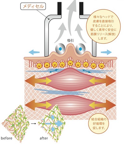 メディセルミニPro8 - 株式会社ヴィクトリー｜整骨院・接骨院・治療院