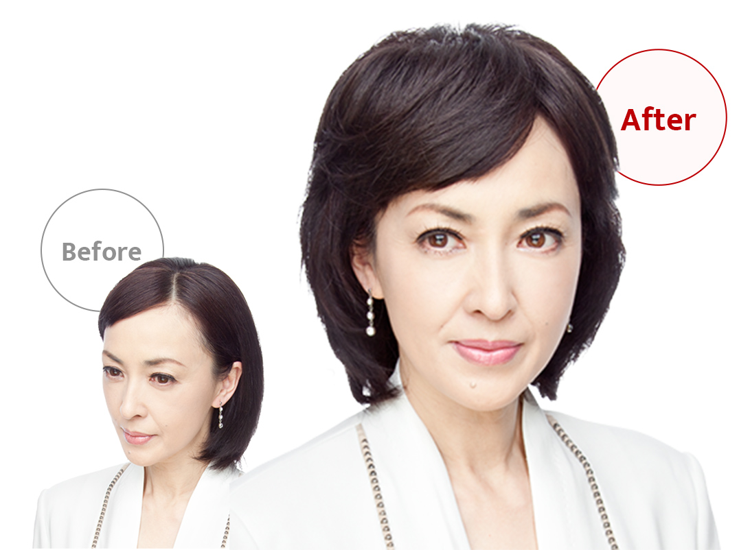 ウィッグユキのポイントウィッグを部分別にご紹介