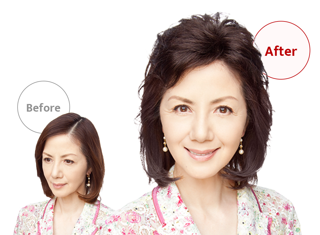 ウィッグユキのポイントウィッグを部分別にご紹介