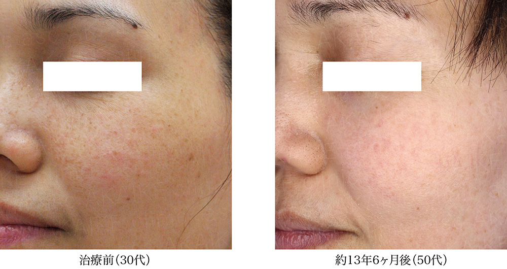 徳島 ゼオスキンヘルス セラピューティック | 高品質なスキンケア治療