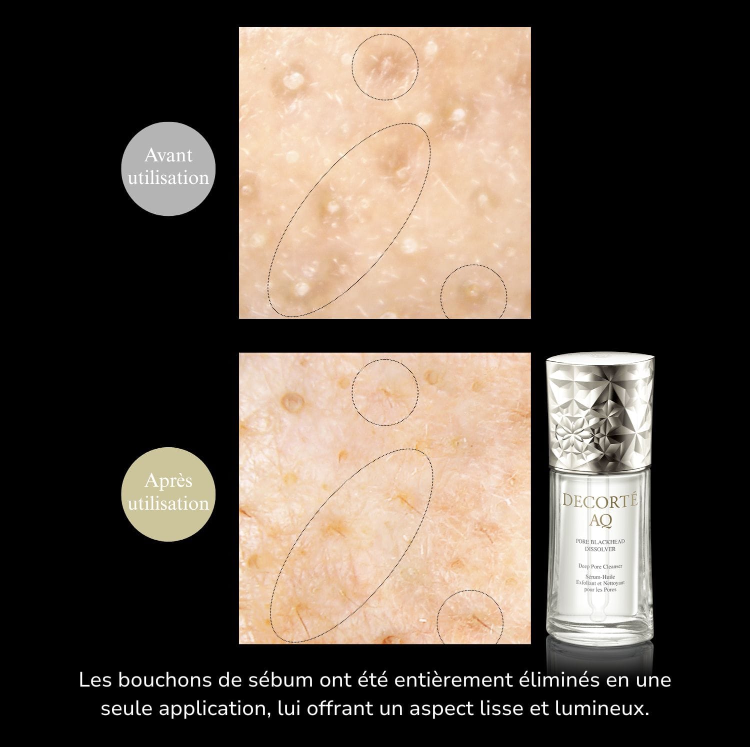 AQ Pore Dissolver | Decorte Cosmetics