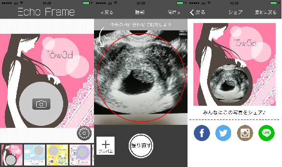 エコー写真を可愛く加工！アプリ「エコーフレーム」が提供開始～大切な