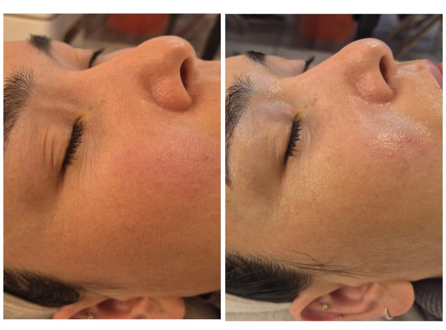 ララドクター（LHALA Doctor）｜美容皮膚科エルムクリニック