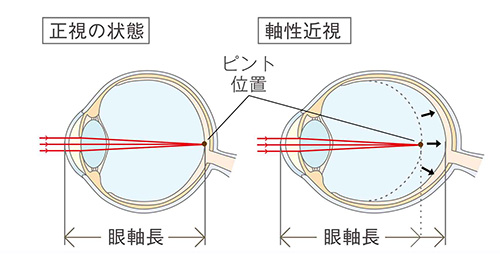 リジュセアミニロートクリアビジョンジュニアEX｜札幌市中央区｜市立