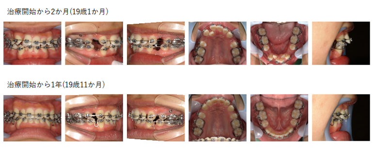 くしま矯正歯科｜阿倍野区・昭和町駅すぐ