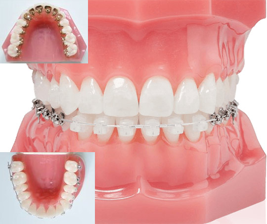 豊橋市の矯正歯科 - ヒロデンタルクリニック