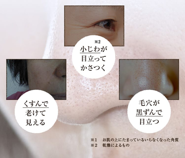 むきたま肌ジェルyawari｜肌のピンチを救うピンチ肌化粧品 I'm PINCH