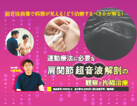 運動療法に必要な肩関節超音波解剖の観察と拘縮治療【全2巻・分売不可