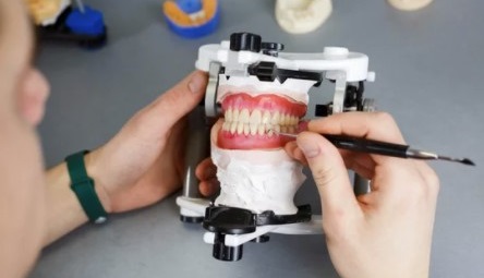 2022年度版」フルデンチャー(総義歯)をデジタル製作する、たった5つの