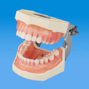 SRP実習用顎模型 [P15FE-500HPRO-S2B1-GSF]｜株式会社ニッシン｜歯科