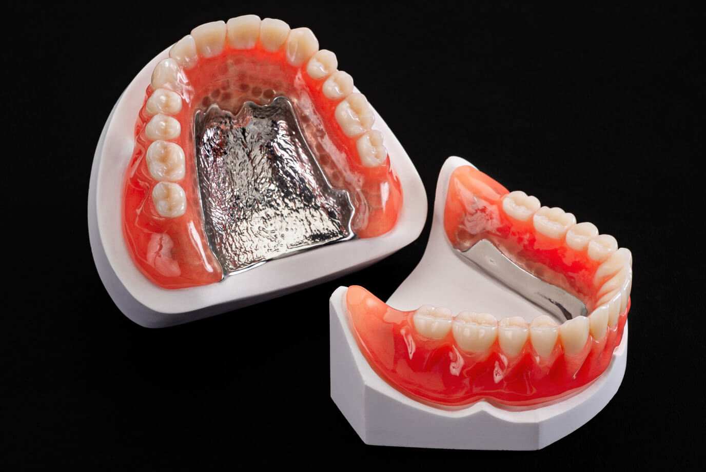 有床義歯補綴物［金属床］｜株式会社シケン