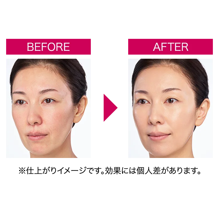 薬用 リンクル美コルセットファンデーション | シワ改善