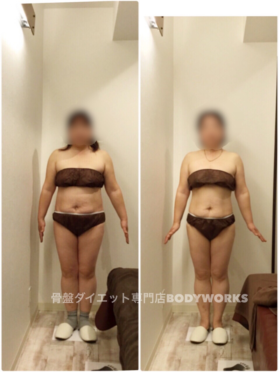 骨盤ダイエット大成功！体重マイナス10㎏ウエスト－12cm | 松戸市の