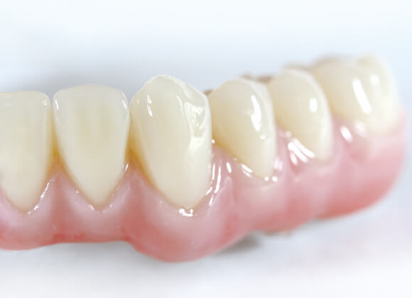 デンチャー｜デンテックインターナショナル