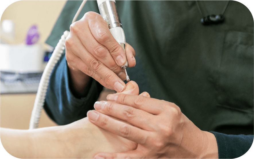 合同会社 プラット巻き爪ケア - 合同会社 プラット