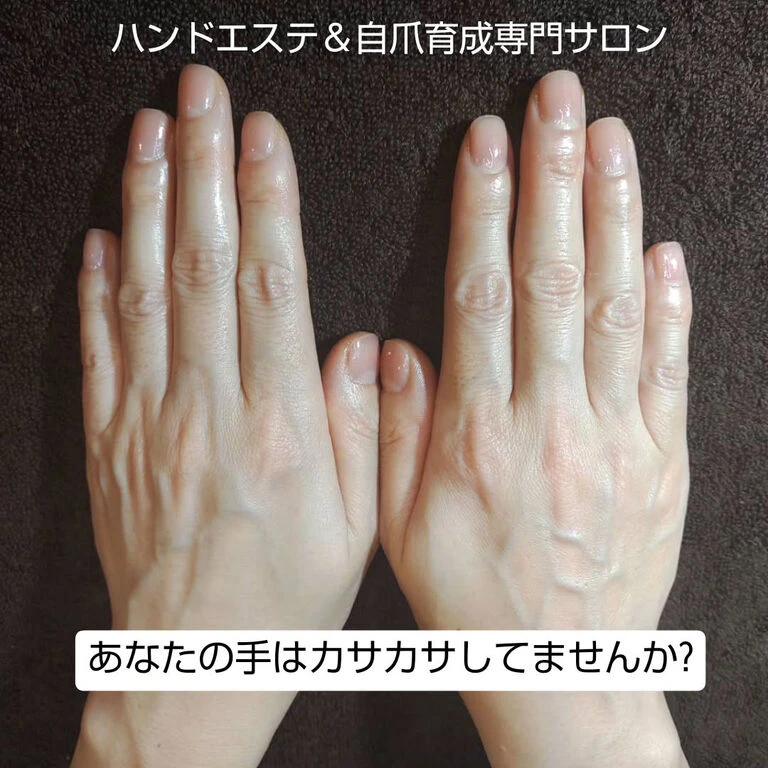 美肌美爪育成「ハンドエステ機 ルビッシュ」導入しました♪ | Blog