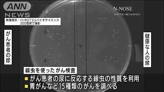 尿1滴で・・・線虫がん検査の拠点が新宿にオープン(2021年7月21日