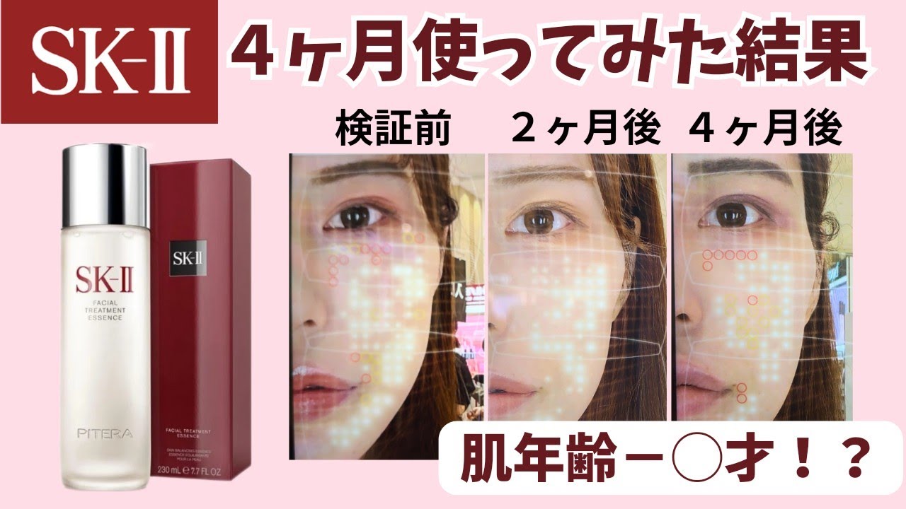 Review of using all three bottles!] How much can SK-II make your