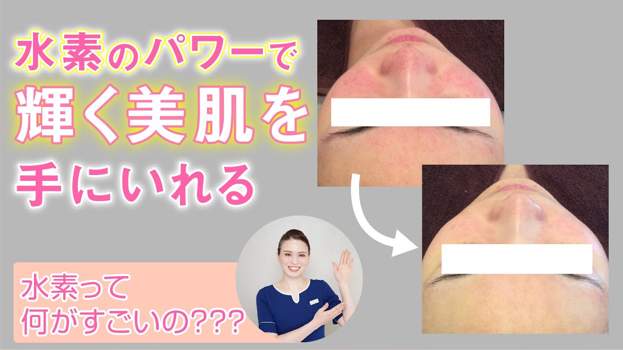 ドクターリセラ】SPセルース（スーパーセルース） 1g – SALONE FAMILIA