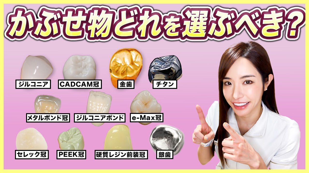 Covering for molars and front teeth] Which one lasts the longest