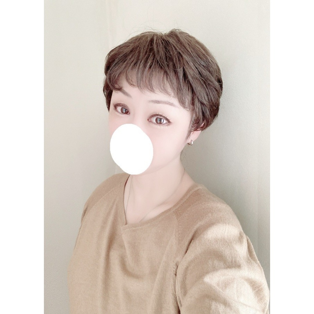 アデランス - フォンテーヌ VALAN PREMIUM VP05 人工スキン付き