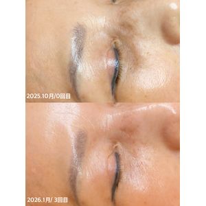 大阪 リアボーテ】クレアスキンのクリスマスコフレ ご紹介