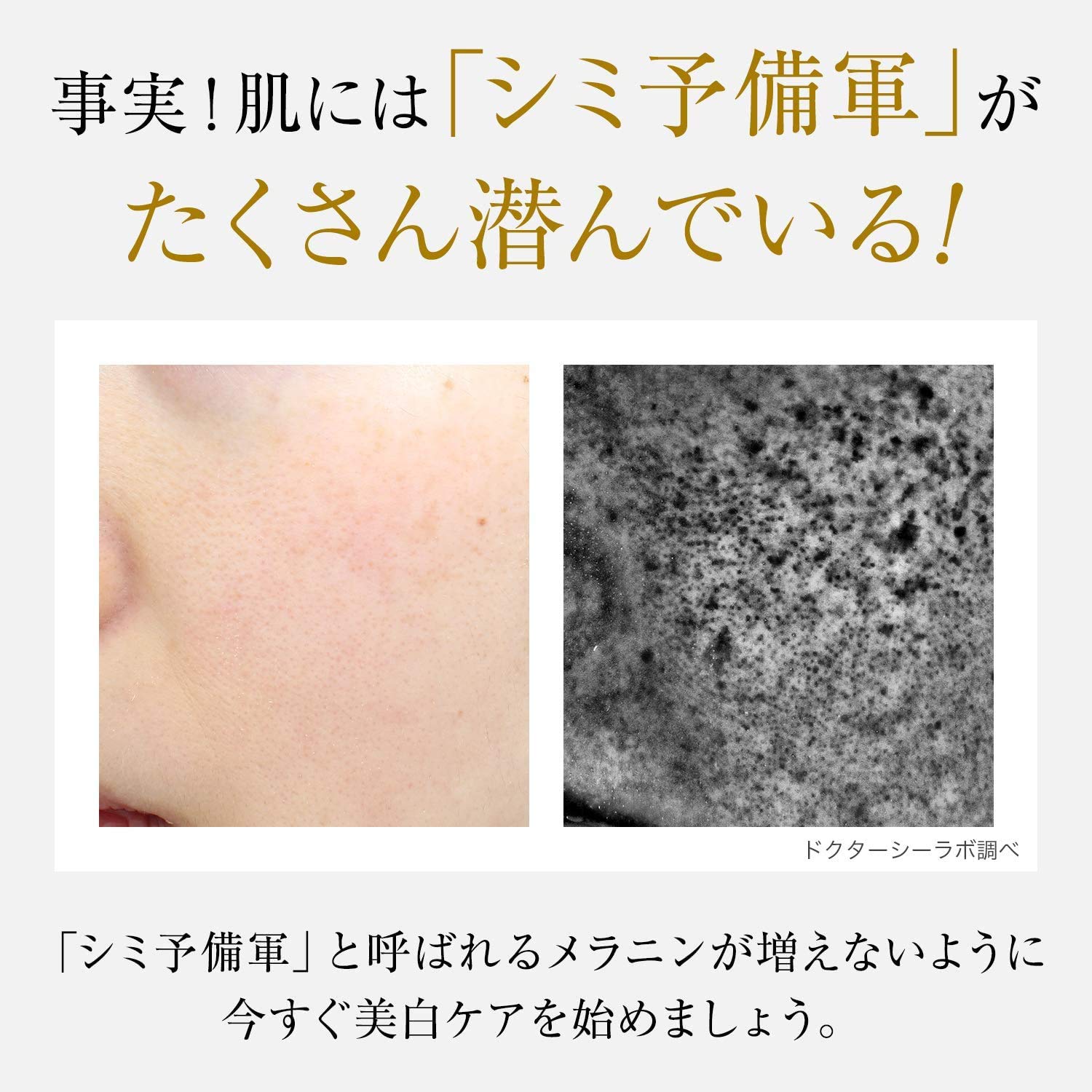 Amazon | (旧モデル) 薬 用 アクア コラーゲン ゲル 美白 EX 200g