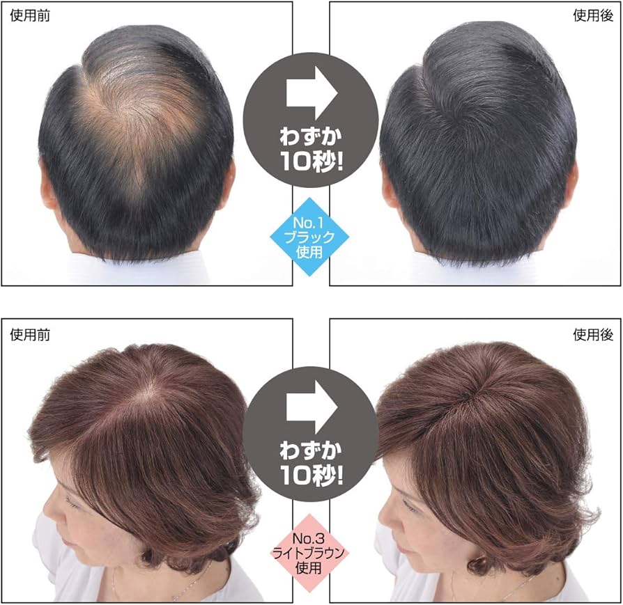 Amazon.co.jp: スーパーミリオンヘアー トライアルセット (スーパー