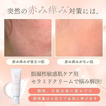 Amazon | 突然の赤み痒みに クレチュール ナノメラクリームα 低刺激