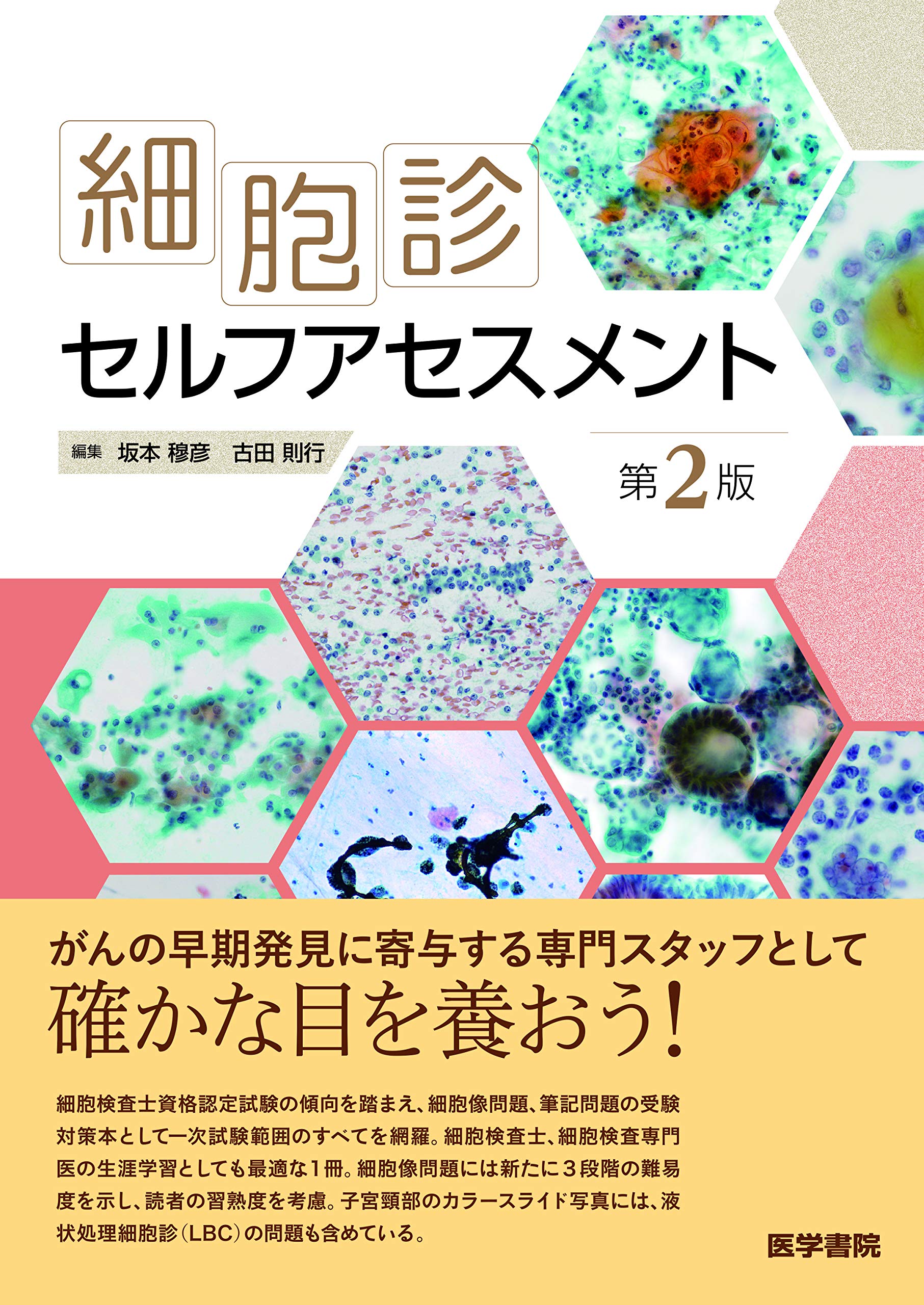 細胞診セルフアセスメント 第2版 | 坂本 穆彦 |本 | 通販 | Amazon