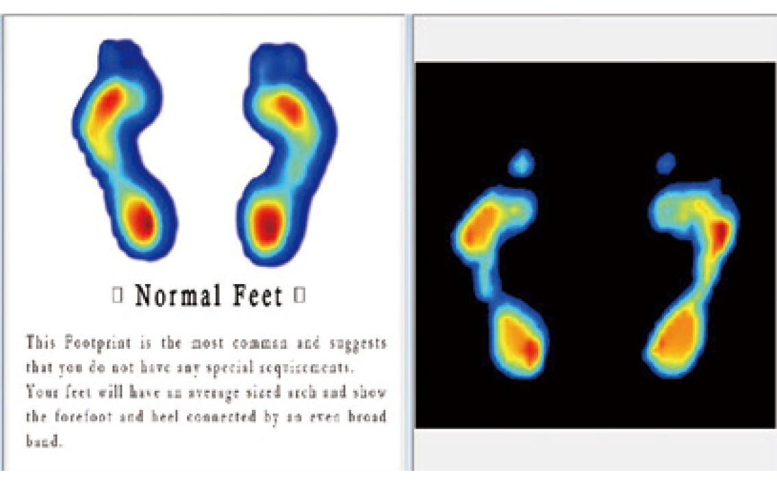 フットチェッカー Foot Checker｜足圧・姿勢・重心バランスを可視化