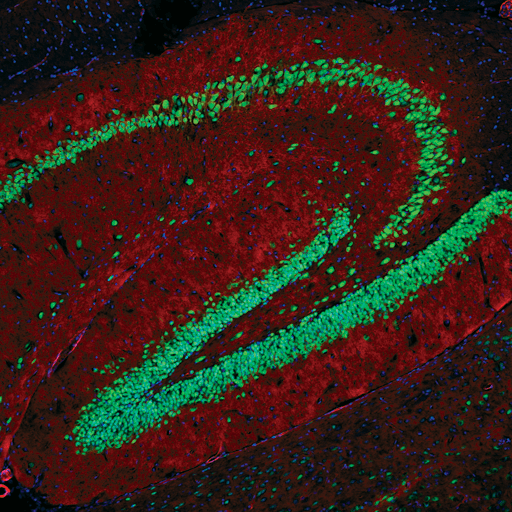 ニューロン、アストロサイト、オリゴデンドロサイトのマーカー | Cell