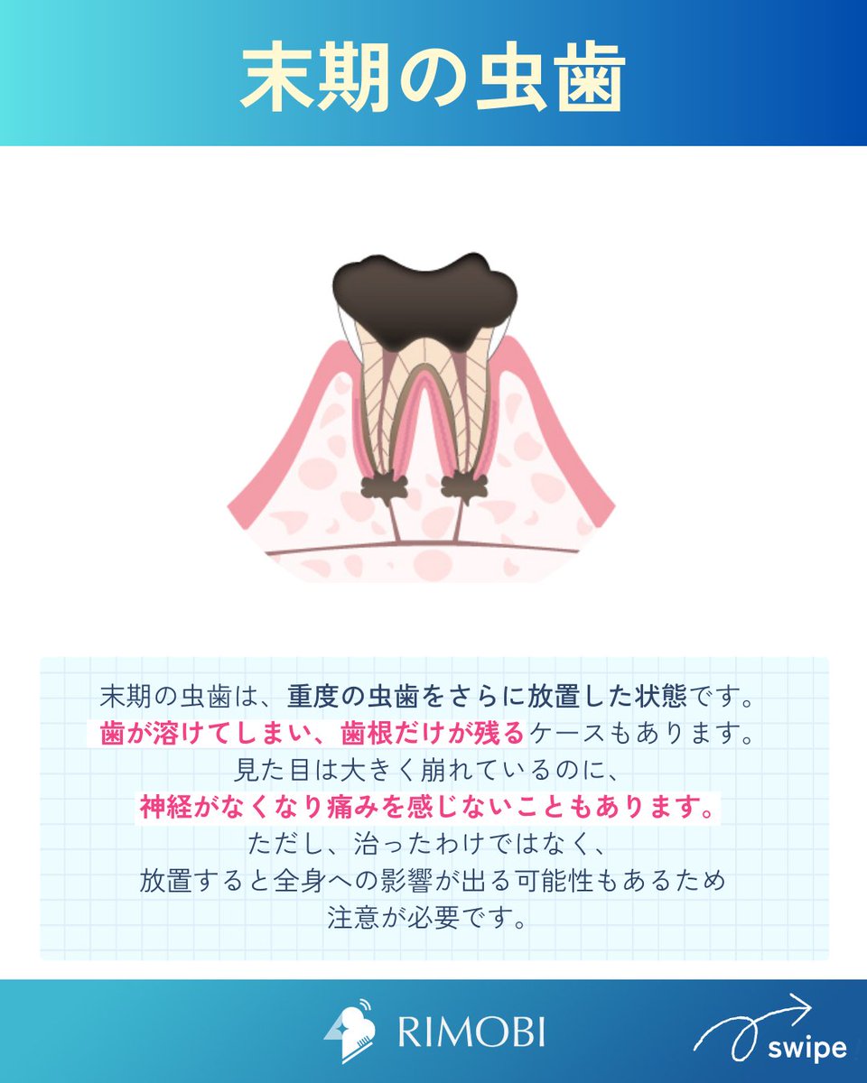 RIMOBI(リモビ)｜DENNOVATE(ディノベート)取扱 (@rimobi_dental