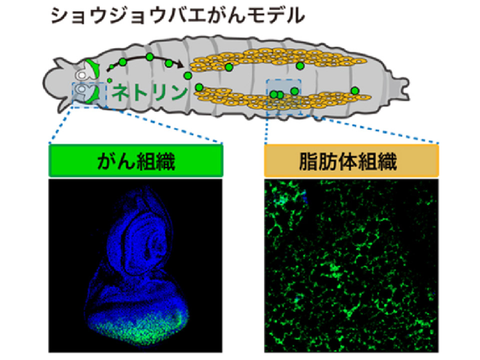 進行がんの全身悪化に関わるタンパク質を発見 理研、生存率やQOL改善に