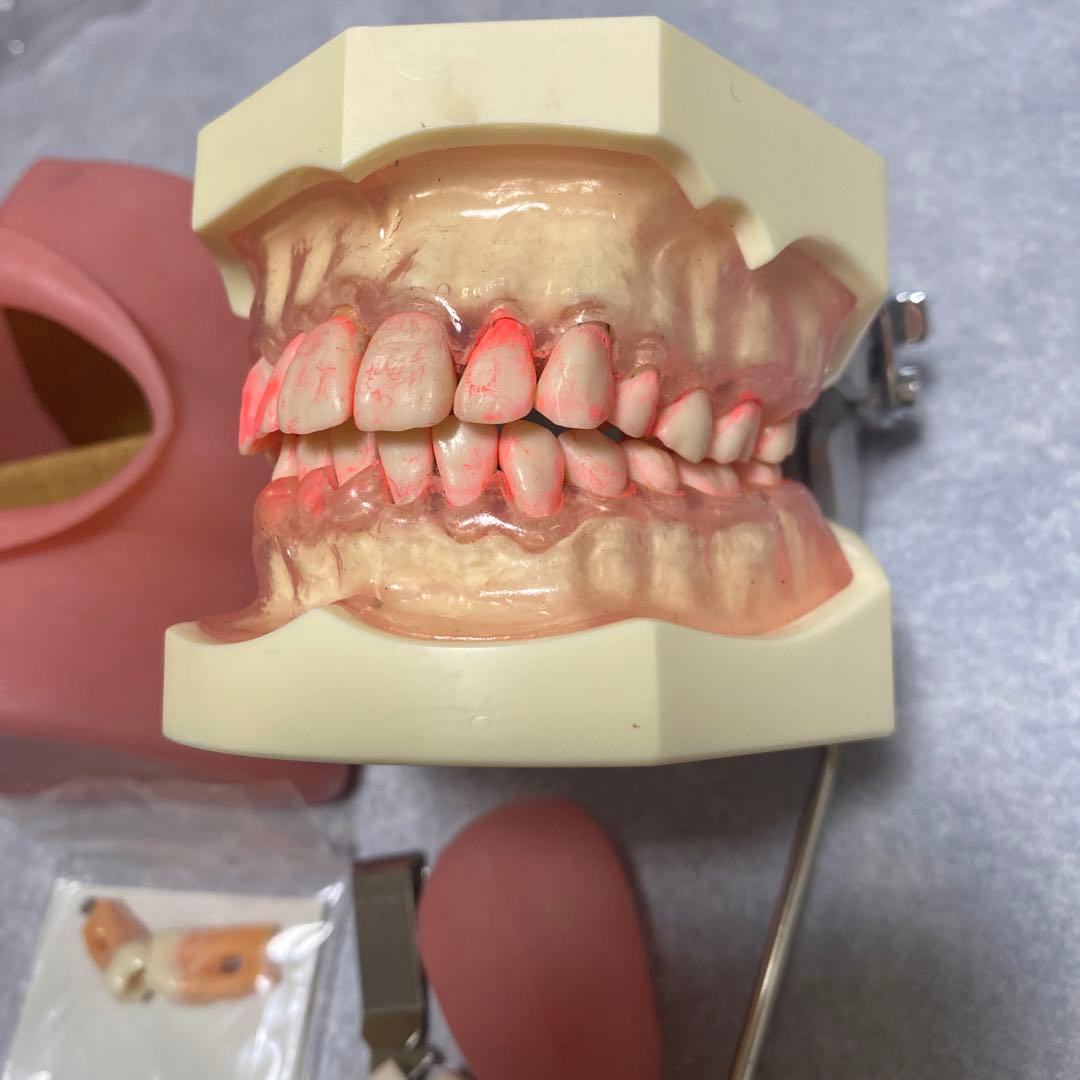 NISSIN DENTAL MODEL 顎模型 頬粘膜 舌付 - メルカリ