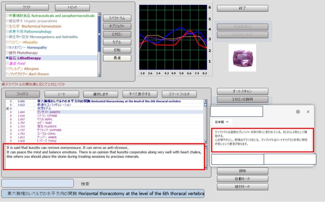 1年保証】PC付 バイオレゾナンス波動測定器 ニュースキャン 翻訳ソフト