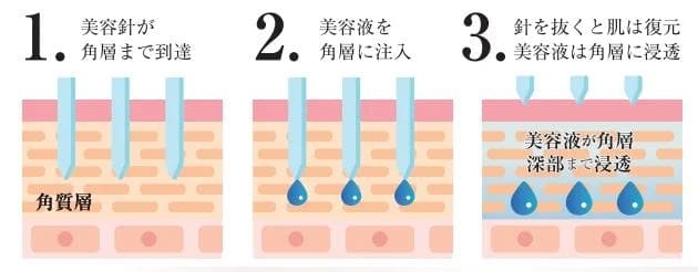 IPS DERMA INJECTORダーマインジェクター2.5ml 箱入り日本製