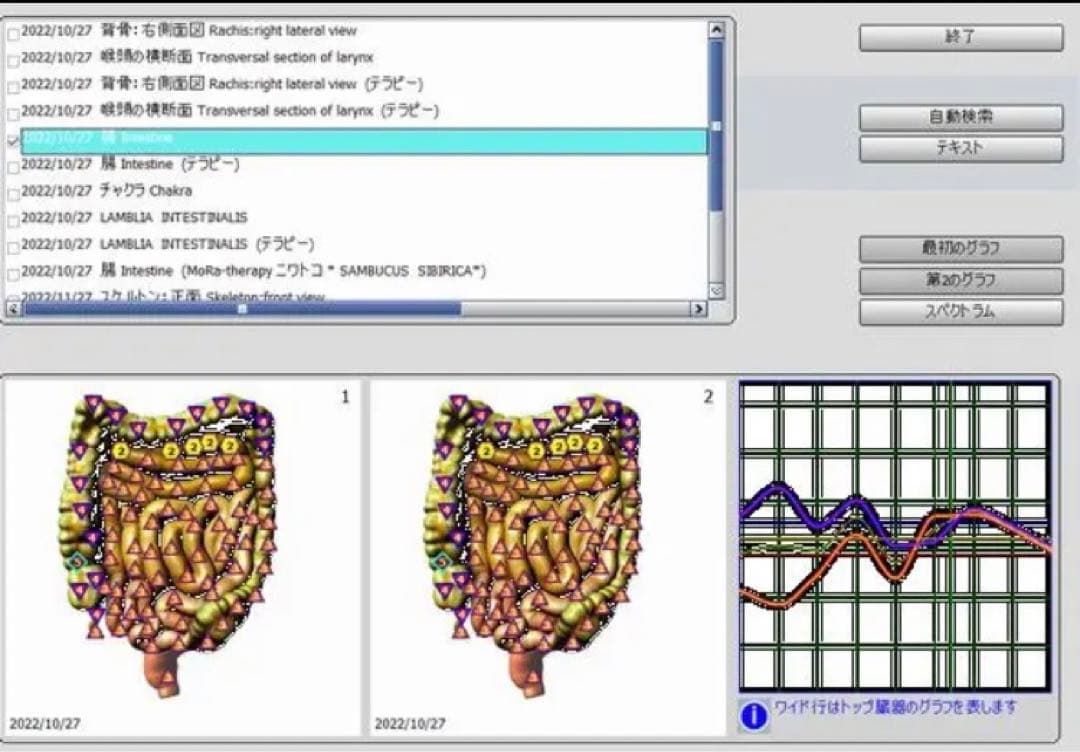 バイオプラズマ【カスタマイズ和訳版】